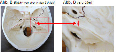 Facialis_1