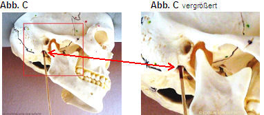 Facialis_2