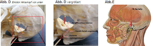 Facialis_3